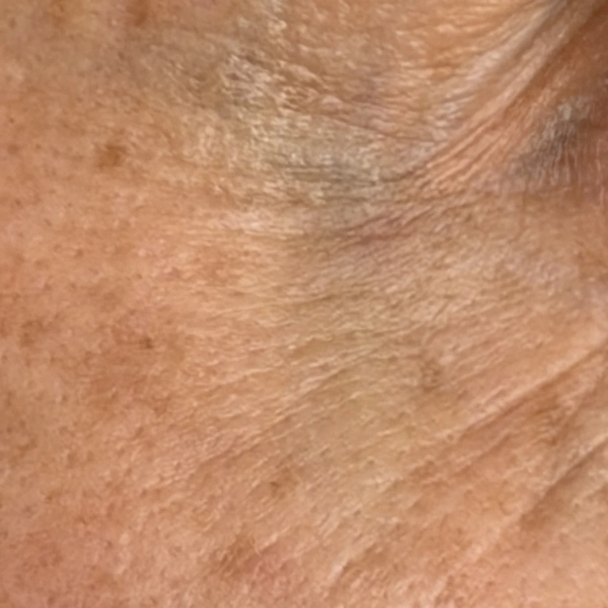 Eye area before using SEISUI